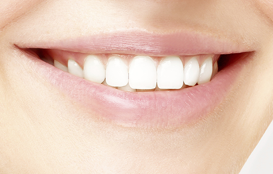 Teeth Whitening